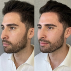 Cepillo facial para masaje linfático
